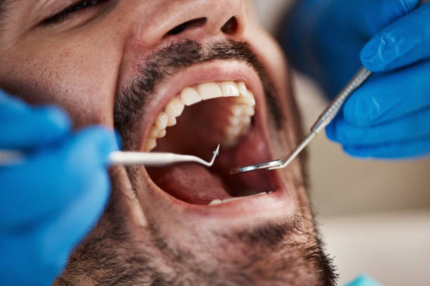 Best Dental Fillings (Composite and Amalgam)  in Fresno, TX